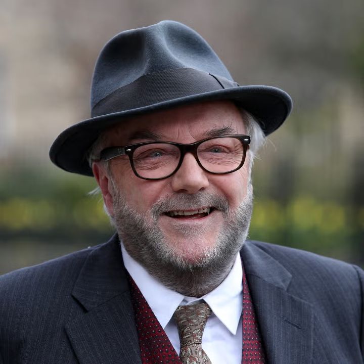 George Galloway's plastic surgery features Botox and fillers.