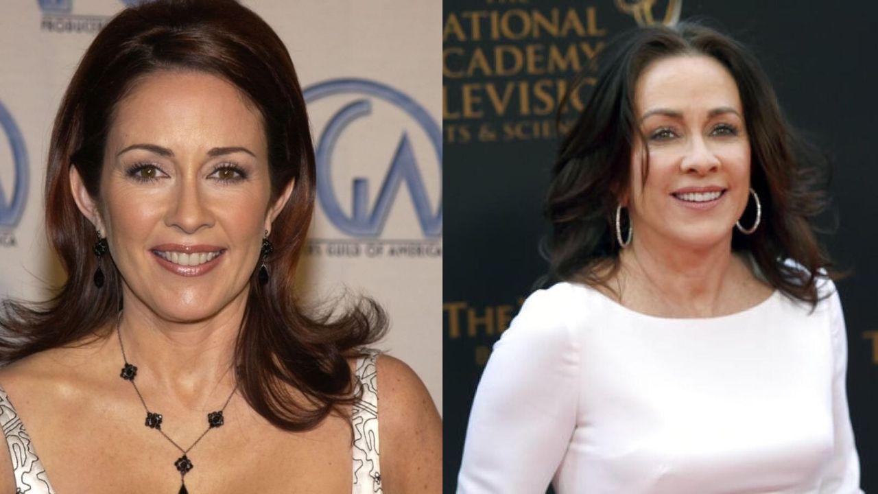 Patricia Heaton felt better and got more confident after getting cosmetic work done. houseandwhips.com