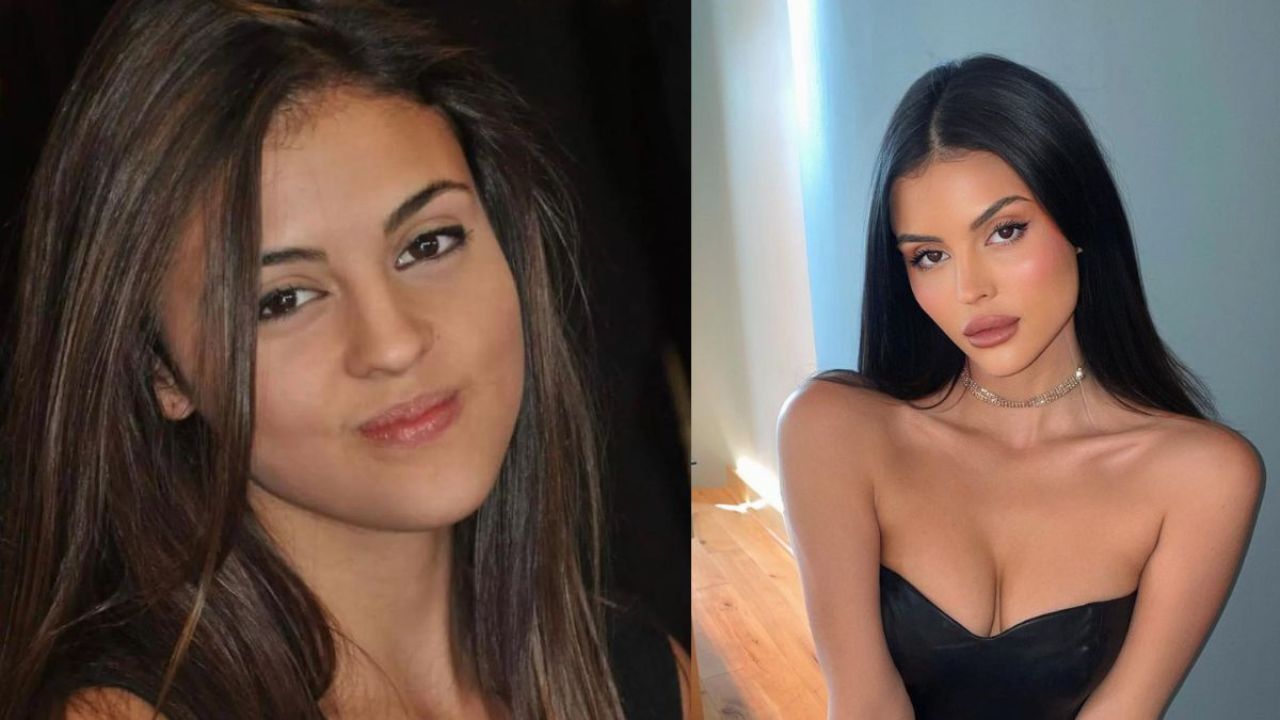 Perfect Match: Holly Before and After Plastic Surgery